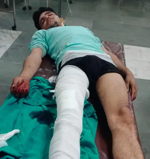 कांग्रेस MLA ऑफिस फायरिंग केस: आरोपी अमन का एनकाउंटर, पैर में गोली लगने के बाद पुलिस ने किया गिरफ्तार